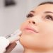 بهترین تزریق ژل لب کاملا طبیعی در فردیس